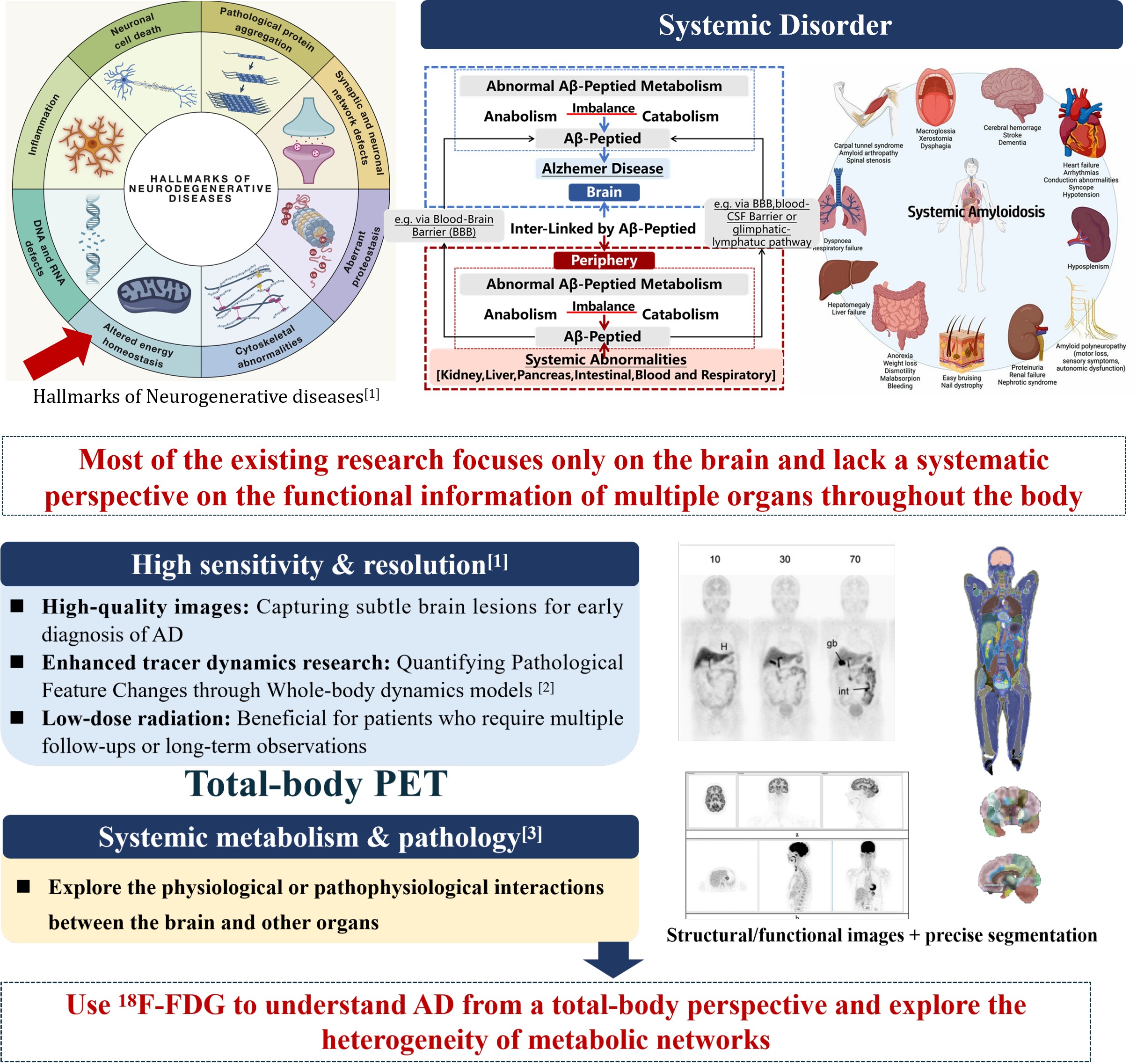 Total-body PET/CT and metabolic network analysis for Alzheimer’s disease